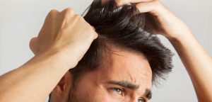 Common Causes of Hair Loss